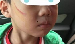 家长爆料孩子被欺负视频